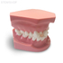 ORB02 – ортодонтическая модель с брекетами и твердой десной, 1 класс | GF Dental (Италия) 