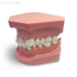 ORB02 – ортодонтическая модель с брекетами и твердой десной, 1 класс | GF Dental (Италия) 