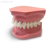 ORB03 – ортодонтическая модель с брекетами и твердой десной, 2 класс | GF Dental (Италия) 