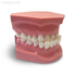 ORB04 – ортодонтическая модель с брекетами и твердой десной | GF Dental (Италия) 