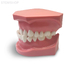 ORB04 – ортодонтическая модель с брекетами и твердой десной | GF Dental (Италия) 
