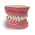 ORB06 – ортодонтическая модель с брекетами и твердой десной, 2 класс | GF Dental (Италия) 