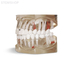 T09 – демонстрационная модель верхней и нижней челюсти увеличенная 3:1, с различным патологиями | GF Dental (Италия)