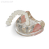 T10 – демонстрационная модель верхней челюсти с 6 имплантами и протезом | GF Dental (Италия)