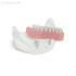 T11 – демонстрационная модель нижней челюсти с имплантами | GF Dental (Италия)