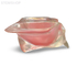 T21 – демонстрационная модель верхней челюсти с атрофией альвеолярного гребня | GF Dental (Италия)