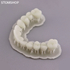 Gorky Liquid Dental Crown FL SLA - фотополимерная смола для стоматологии, цвет А1-А2, А2, А3 по шкале Вита, 1 кг | Gorky Liquid (Россия)