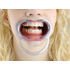 Spandex S/M - щечно-губной ретрактор, 2 шт. | Hager & Werken (Германия)
