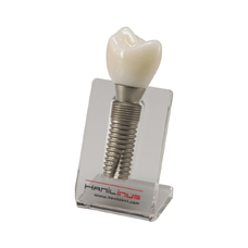 SINGLE IMPLANT MODEL - демонстрационная модель зуба со съёмной коронкой