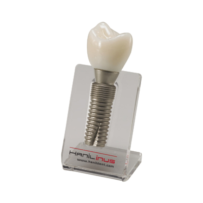 SINGLE IMPLANT MODEL - демонстрационная модель зуба со съёмной коронкой | Hanil (Ю. Корея)