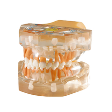 TOOTH MODEL F-TYPE - прозрачная модель, демонстрирующая прорезывание зубов