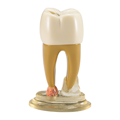 TOOTH MODEL R-TYPE - разборная модель зуба | Hanil (Ю. Корея)