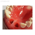 ЧИ-14 – модель челюсти для практики имплантации и пересадки трансплантата | Medskills (Россия)