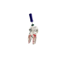 Прозрачный эндоблок для обучения препарированию корневого канала 6 зуба