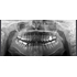 RAYSCAN Symphony Alpha PANO - ортопантомограф с возможностью дооснащения цефалостатом и компьютерным томографом | Ray Co., Ltd. (Ю. Корея)