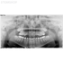 I-Max Touch Pano - цифровой панорамный рентгеновский аппарат | Owandy (Франция)