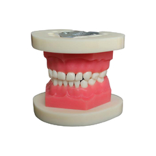ЧВН-20Э - денто-модель для практики экстракции временных зубов