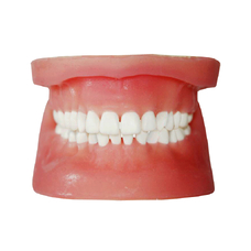 МУ0324 - денто-модель верхней и нижней челюстей для практики удаления ретенированных зубов