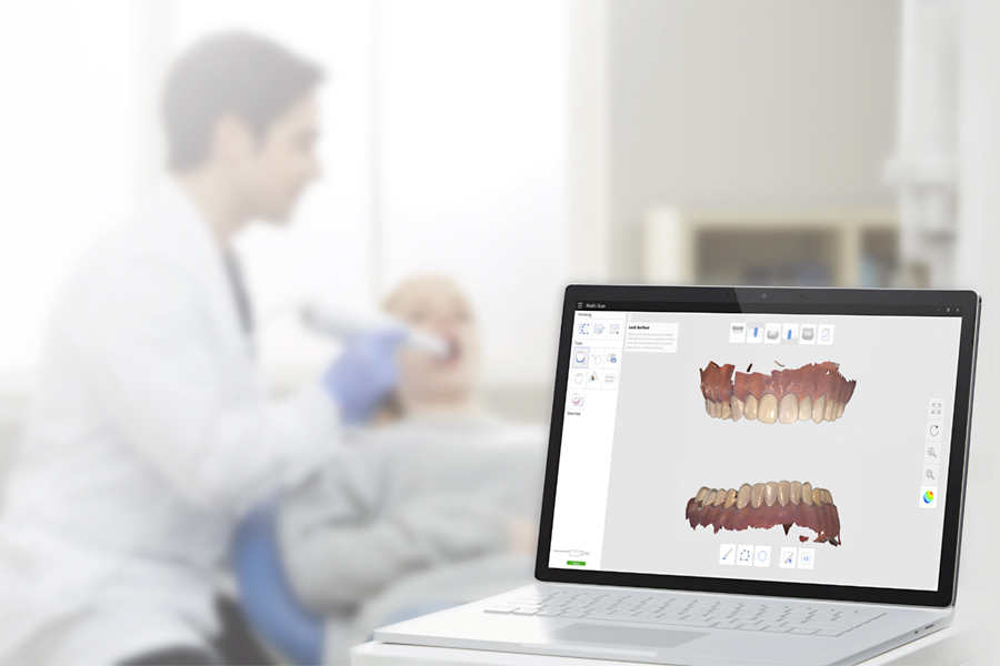 Интраоральный сканер Medit i500: цифровой подход к стоматологии